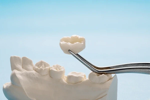 dental crowns in london on