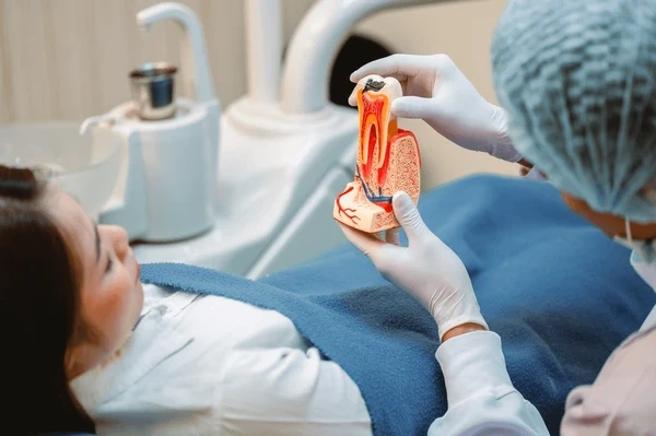 root canal treatment in london on